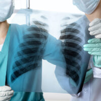 Cropped view of two doctors woman and man in medical apparel holding x-ray rib cage, lungs, thorax Cropped view of two doctors woman and man in medical apparel holding x-ray rib cage, lungs, thorax