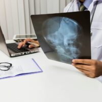 Doctor diagnose and analyze on x-ray film of patient. Medicine and health care concept. Doctor diagnose and analyze on x-ray film of patient. Medicine and health care concept.