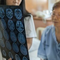 Brain disease diagnosis with medical doctor diagnosing elderly