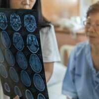 Brain disease diagnosis with medical doctor diagnosing elderly Brain disease diagnosis with medical doctor diagnosing elderly